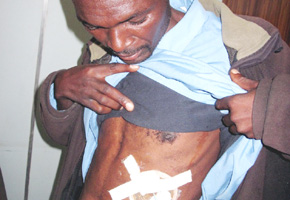 Man told to die first so he can claim pension
