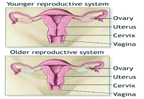 OPINION: Misconceptions about menopause