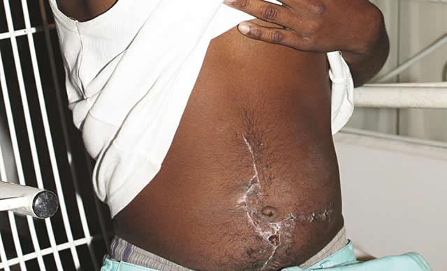 Man’s stomach ripped open over $1