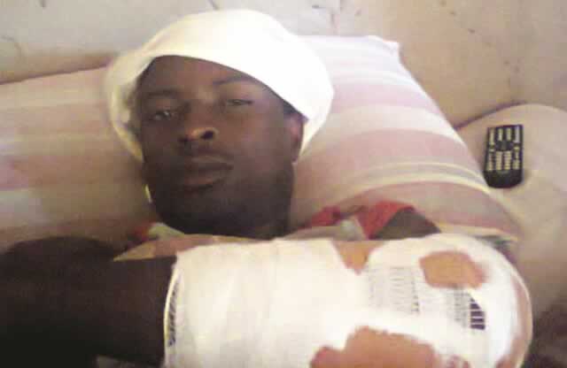 Man survives leopard’s maul