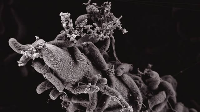 Cholera outbreak claims 19 in Mozambique