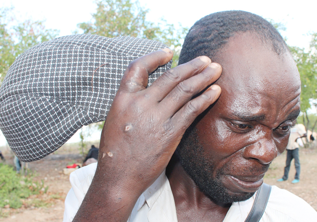 Tormented Zimbabweans counselled