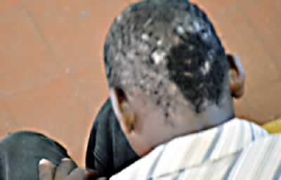 Scars of step-parents indelible