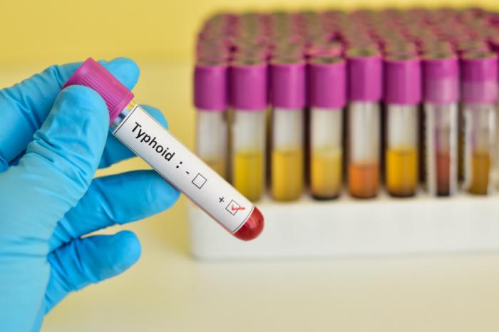 Typhoid kills pupil in Redcliff