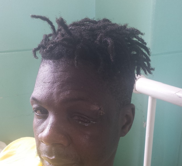 Man loses eye, cash in robbery