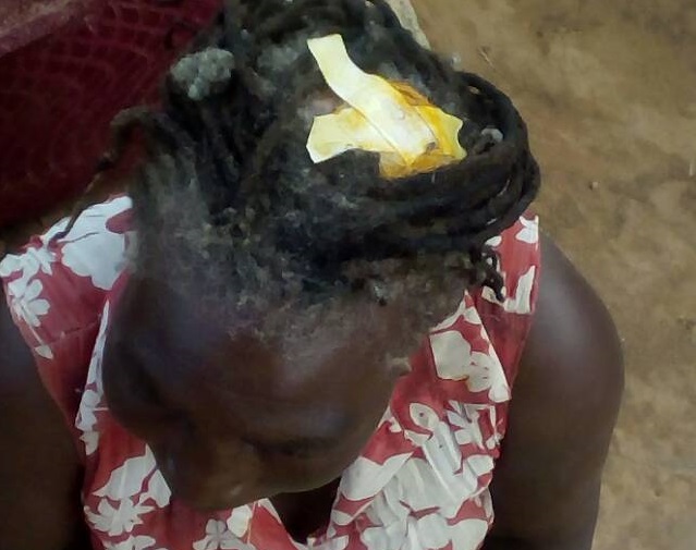3 children die in hailstorm