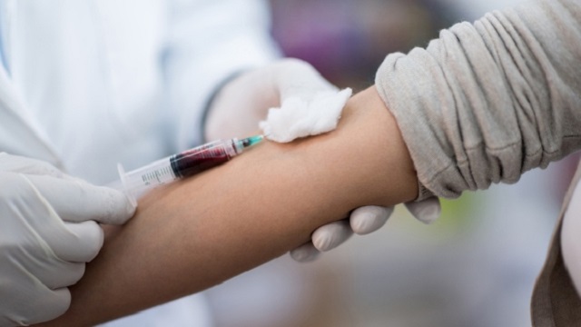 Scientists develop ‘world’s first’ melanoma blood test