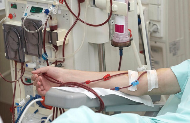 Kidney dialysis now free