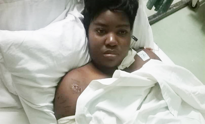 Dog attack woman battles for life