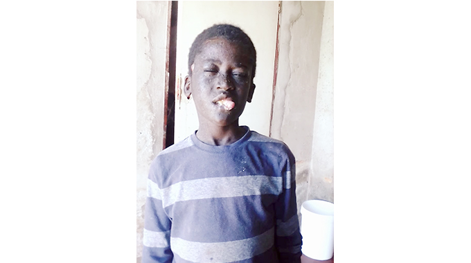 Boy with lip growth condition seeks help