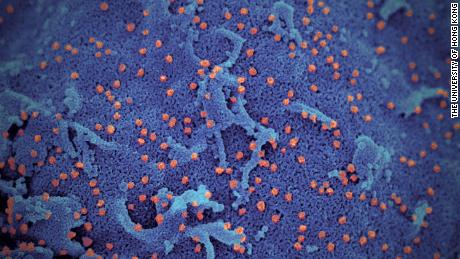 While nationwide surge may be slowing, officials warn of troubling Covid-19 signs across US heartland