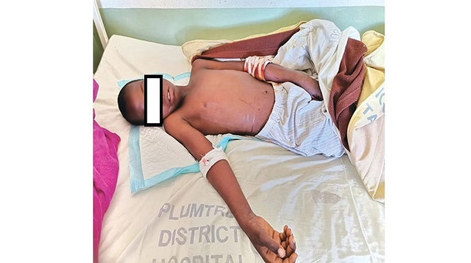 Hippo attack: Boy (11) lucky to be alive