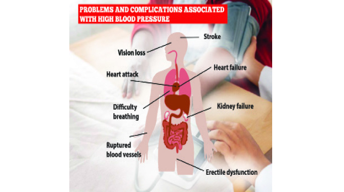 Hypertension cases rise in Zimbabwe