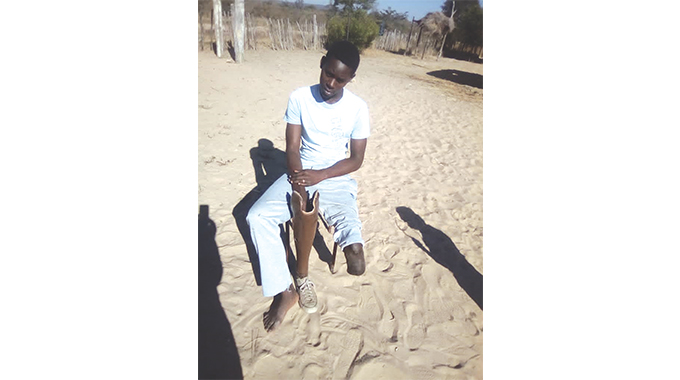 Crocodile attack survivor seeks help