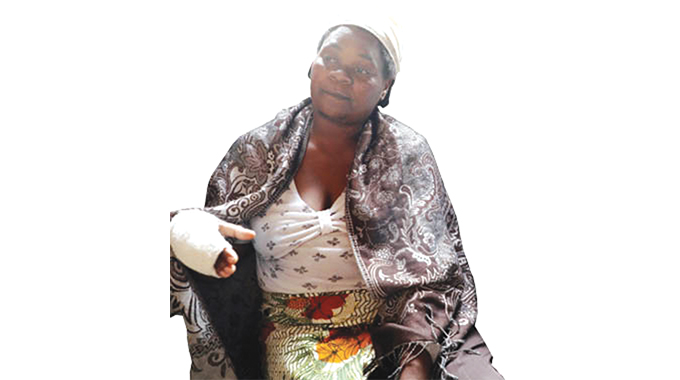 Petrol explosion victim seeks help