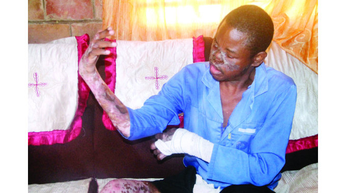 Man with rare skin condition seeks help