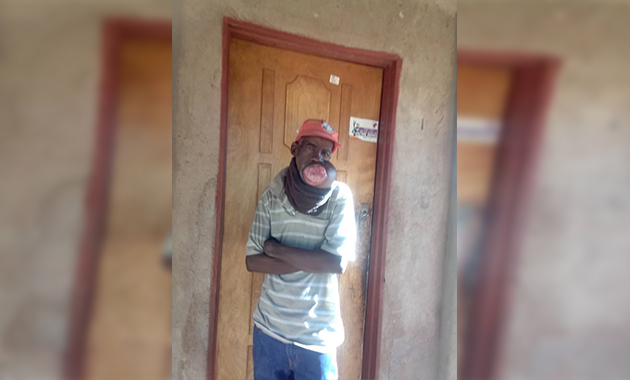 Beitbridge man who has battled cancer for 17 years appeals for financial help to get surgery
