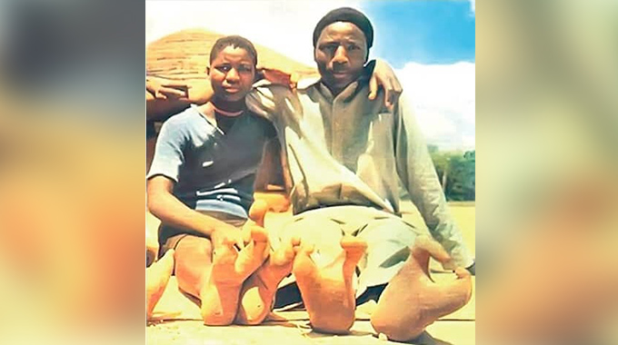 Two-toed people of Zimbabwe…The Doma tribe promoting indigenous tourism